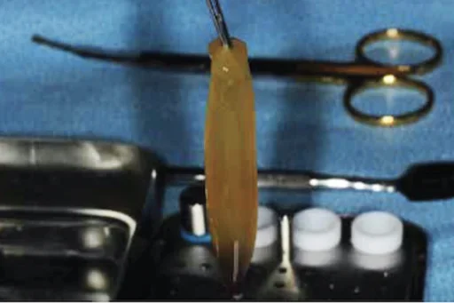 Surgical tray with instruments