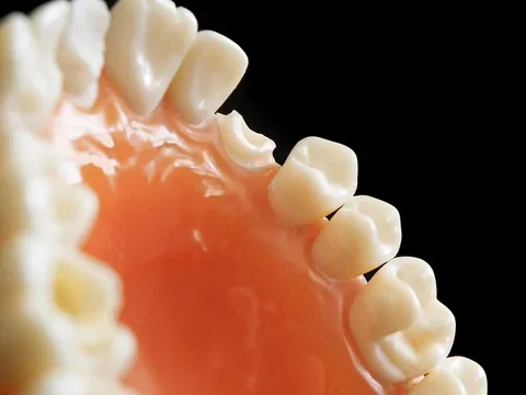 dental arch model with prepared tooth