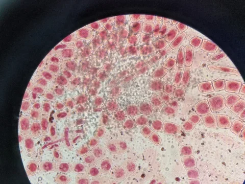 Cells under microscope 