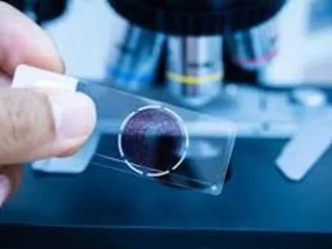 Pathology Slide Image