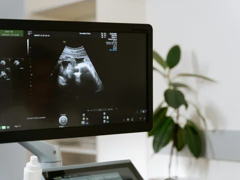 photo of ultrasound testing