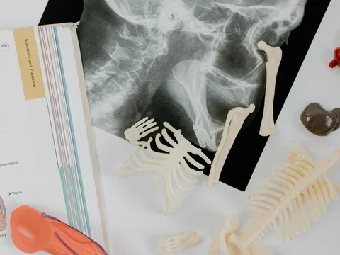image of skull x-ray on a table with an open book in the corner and small plastic skeleton/body part recreations